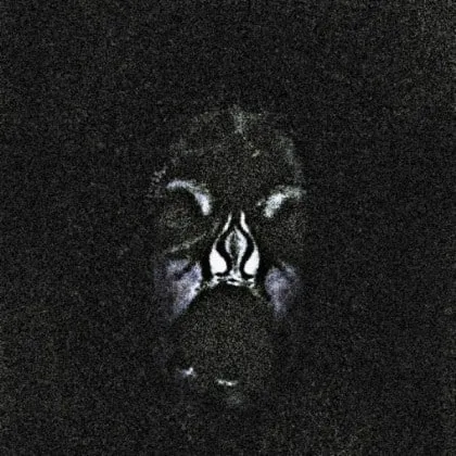 'Noise